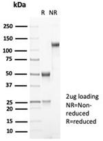 MDM2 Antibody in SDS-PAGE (SDS-PAGE)