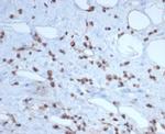 MDM2 Antibody in Immunohistochemistry (Paraffin) (IHC (P))