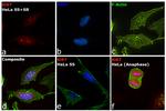 Ki-67 Antibody