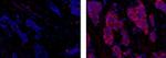 CD227 (Mucin 1) Antibody in Immunohistochemistry (Paraffin) (IHC (P))