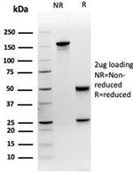 MEF2D/Myocyte enhancer factor 2D (Transcription Factor) Antibody in SDS-PAGE (SDS-PAGE)