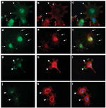 alpha Actinin 4 Antibody in Immunocytochemistry (ICC/IF)