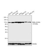 alpha Actinin 4 Antibody in Western Blot (WB)