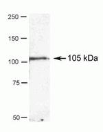 alpha Actinin 4 Antibody in Western Blot (WB)