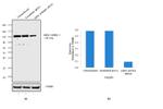 alpha Actinin 4 Antibody in Western Blot (WB)