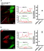 Sigma-1 Receptor Antibody in Immunocytochemistry (ICC/IF)