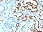 Milk Fat Globule (Breast Epithelial Marker) Antibody in Immunohistochemistry (Paraffin) (IHC (P))