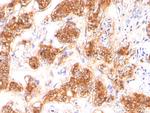 Milk Fat Globule (Breast Epithelial Marker) Antibody in Immunohistochemistry (Paraffin) (IHC (P))