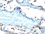 Milk Fat Globule (Breast Epithelial Marker) Antibody in Immunohistochemistry (Paraffin) (IHC (P))