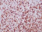 Mammaglobin (SCGB2A2) (Breast Cancer Marker) Antibody in Immunohistochemistry (Paraffin) (IHC (P))