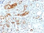 Mammaglobin (SCGB2A2) (Breast Cancer Marker) Antibody in Immunohistochemistry (Paraffin) (IHC (P))