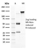 Mammaglobin (SCGB2A2) (Breast Cancer Marker) Antibody in SDS-PAGE (SDS-PAGE)