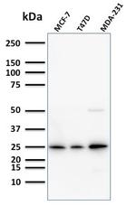 Mammaglobin (SCGB2A2) (Breast Cancer Marker) Antibody in Western Blot (WB)