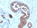 Mammaglobin (SCGB2A2) (Breast Cancer Marker) Antibody in Immunohistochemistry (Paraffin) (IHC (P))