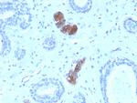 Mammaglobin (SCGB2A2) (Breast Cancer Marker) Antibody in Immunohistochemistry (Paraffin) (IHC (P))