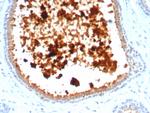 Mammaglobin (SCGB2A2) (Breast Cancer Marker) Antibody in Immunohistochemistry (Paraffin) (IHC (P))