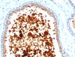 Mammaglobin (SCGB2A2) (Breast Cancer Marker) Antibody in Immunohistochemistry (Paraffin) (IHC (P))