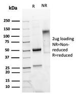 Mammaglobin (SCGB2A2) (Breast Cancer Marker) Antibody in SDS-PAGE (SDS-PAGE)