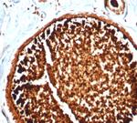 Mammaglobin (SCGB2A2) (Breast Cancer Marker) Antibody in Immunohistochemistry (Paraffin) (IHC (P))