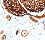 Mammaglobin (SCGB2A2) (Breast Cancer Marker) Antibody in Immunohistochemistry (Paraffin) (IHC (P))