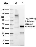 Mammaglobin (SCGB2A2) (Breast Cancer Marker) Antibody in SDS-PAGE (SDS-PAGE)