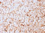 Mammaglobin (SCGB2A2) (Breast Cancer Marker) Antibody in Immunohistochemistry (Paraffin) (IHC (P))