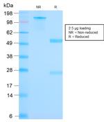 Mammaglobin (SCGB2A2) (Breast Cancer Marker) Antibody in SDS-PAGE (SDS-PAGE)