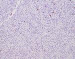 MGMT (Marker of Suppressor of Mutation and Carcinogenesis) Antibody in Immunohistochemistry (Paraffin) (IHC (P))