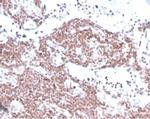 MGMT (Marker of Suppressor of Mutation and Carcinogenesis) Antibody in Immunohistochemistry (Paraffin) (IHC (P))