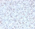 MGMT (Marker of Suppressor of Mutation and Carcinogenesis) Antibody in Immunohistochemistry (Paraffin) (IHC (P))