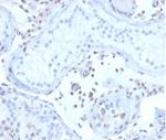 MGMT (Marker of Suppressor of Mutation and Carcinogenesis) Antibody in Immunohistochemistry (Paraffin) (IHC (P))