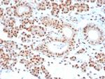 MGMT (Marker of Suppressor of Mutation and Carcinogenesis) Antibody in Immunohistochemistry (Paraffin) (IHC (P))