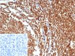 MGMT (Marker of Suppressor of Mutation and Carcinogenesis) Antibody in Immunohistochemistry (Paraffin) (IHC (P))