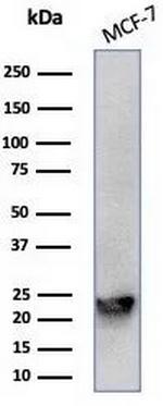 MGMT (Marker of Suppressor of Mutation and Carcinogenesis) Antibody in Western Blot (WB)