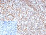 MGMT (Marker of Suppressor of Mutation and Carcinogenesis) Antibody in Immunohistochemistry (Paraffin) (IHC (P))