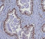 MGMT (Marker of Suppressor of Mutation and Carcinogenesis) Antibody in Immunohistochemistry (Paraffin) (IHC (P))