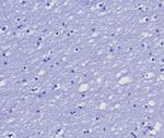 MGMT (Marker of Suppressor of Mutation and Carcinogenesis) Antibody in Immunohistochemistry (Paraffin) (IHC (P))