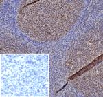 MGMT (Marker of Suppressor of Mutation and Carcinogenesis) Antibody in Immunohistochemistry (Paraffin) (IHC (P))