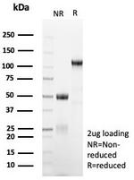 MGMT (Marker of Suppressor of Mutation and Carcinogenesis) Antibody in SDS-PAGE (SDS-PAGE)