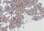 MGMT (Marker of Suppressor of Mutation and Carcinogenesis) Antibody in Immunohistochemistry (Paraffin) (IHC (P))