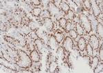 MGMT (Marker of Suppressor of Mutation and Carcinogenesis) Antibody in Immunohistochemistry (Paraffin) (IHC (P))