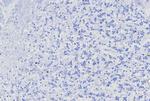 MGMT (Marker of Suppressor of Mutation and Carcinogenesis) Antibody in Immunohistochemistry (Paraffin) (IHC (P))