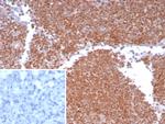 MGMT (Marker of Suppressor of Mutation and Carcinogenesis) Antibody in Immunohistochemistry (Paraffin) (IHC (P))