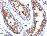 CD99/MIC2 (Ewing's Sarcoma Marker) Antibody in Immunohistochemistry (Paraffin) (IHC (P))