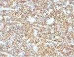 CD99/MIC2 (Ewing's Sarcoma Marker) Antibody in Immunohistochemistry (Paraffin) (IHC (P))