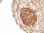 CD99/MIC2 (Ewing's Sarcoma Marker) Antibody in Immunohistochemistry (Paraffin) (IHC (P))