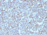 CD99/MIC2 (Ewing's Sarcoma Marker) Antibody in Immunohistochemistry (Paraffin) (IHC (P))