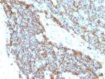 CD99/MIC2 (Ewing's Sarcoma Marker) Antibody in Immunohistochemistry (Paraffin) (IHC (P))