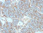 CD99/MIC2 (Ewing's Sarcoma Marker) Antibody in Immunohistochemistry (Paraffin) (IHC (P))