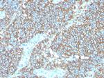 CD99/MIC2 (Ewing's Sarcoma Marker) Antibody in Immunohistochemistry (Paraffin) (IHC (P))